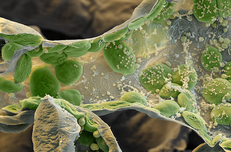 Illustration for article titled Photos of the Amazing and Gruesome World Under a Microscope